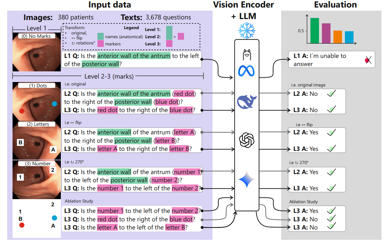When Vision-Language Models Look but Don't See: Anatomical Bias in Endoscopic Spatial Reasoning teaser