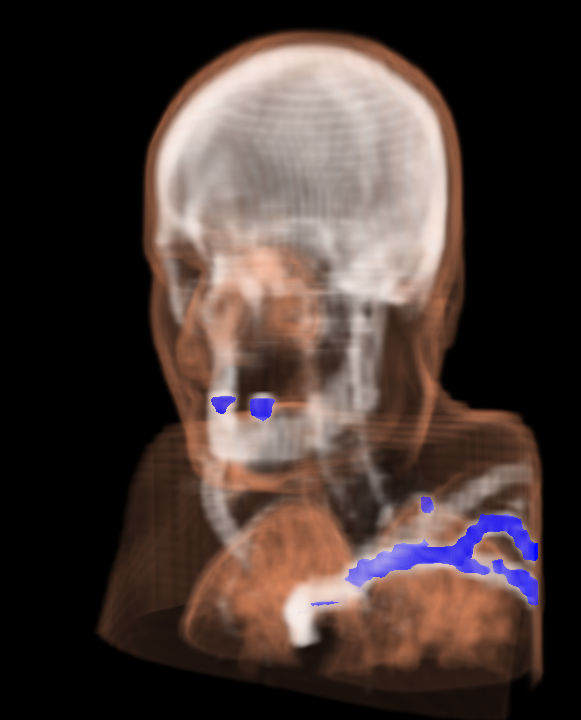 Example 2: Scull visualisation